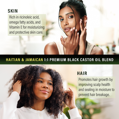 Doyley's Premium Haitian and Jamaican Black Castor Oil 1:1 Blend 4oz